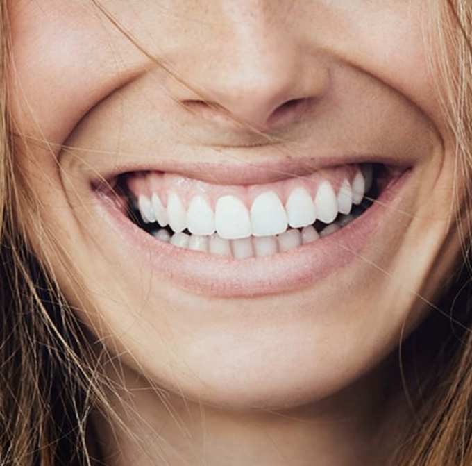 Lachende Frau mit schönen Zähnen